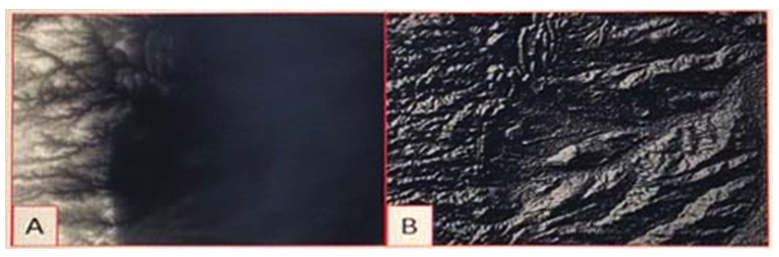 <strong>Refer to the exhibit. Which raster function will display image A as image B?</strong> A) Shaded Relief B) Slope C) Hillshade D) Aspect
