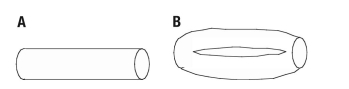 Examine one of the consequences of branching with a simple model shown in the figure. Assume that there are two blood-flow circuits, which are identical except that one of the circuits has a single vessel, whereas the other has two identical vessels in parallel. a. If the resistance of a single vessel is R, what is the overall resistance of the two vessels in parallel? b. If each of the circuits carries the same flow rate, which has the larger pressure drop? How do the two pressure drops compare?