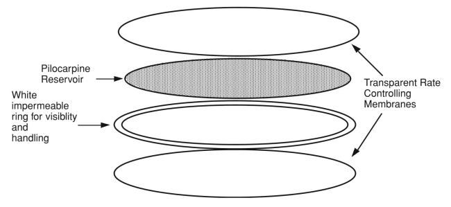 A schematic diagram of the Ocusert?R system for delivery of pilocarpine is shown in the accompanying figure. Using your knowledge of diffusion through polymer membranes (from Chapter 2), derive an equation that will predict the rate of drug release (M, mg/h) from the following parameters: drug concentration in the reservoir (cp, mg/mL), thickness of the membranes (cm), diffusion coefficient of drug in the membrane (DA,cm2/s), and surface area of the device (A,cm2).