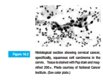 Biological dyes are used to prepare a Pap smear, such as the one shown in Figure 16.2. How do you think these dyes work? Why are different cells, and different regions of cells, different colors?