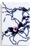 Each numbered figure 1-4 represents a cell that provides an immune defense. Each lettered figure A-D shows a pathogenic microbe. Name the type of defense and match it with its primary target microbe and effects. (1) Figure 14.19 (2) Page 435 (3) Page 435 (4) Page 435 A Figure 18.8 B Figure 23.21 inset C Table 25.1 D Opener, Chapter 14