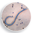 Each numbered figure 1-4 represents a cell that provides an immune defense. Each lettered figure A-D shows a pathogenic microbe. Name the type of defense and match it with its primary target microbe and effects. (1) Figure 14.19 (2) Page 435 (3) Page 435 (4) Page 435 A Figure 18.8 B Figure 23.21 inset C Table 25.1 D Opener, Chapter 14