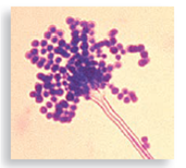 Each numbered figure 1-4 represents a cell that provides an immune defense. Each lettered figure A-D shows a pathogenic microbe. Name the type of defense and match it with its primary target microbe and effects. (1) Figure 14.19 (2) Page 435 (3) Page 435 (4) Page 435 A Figure 18.8 B Figure 23.21 inset C Table 25.1 D Opener, Chapter 14