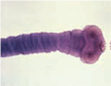 Observe figures a, b, c, and d and identify the parasite shown. (a) (b) (c) (d)