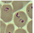 Observe figures a, b, c, and d and identify the parasite shown. (a) (b) (c) (d)