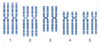 Suppose you performed a fluorescence in situ hybridization experiment (FISH) on chromosomes from a human cell using a probe corresponding to a gene located near (but not at) the telomere of the q arm of chromosome 4. a. On the following idiogram, which shows only chromosomes 1-5 contained in this diploid cell, indicate the location of all fluorescent signals. b. Compare your idiogram with the result of the FISH experiment shown in Fig. 11.9a. Why are the chromosomes scattered in Fig. 11.9a, rather than being present in neatly arranged pairs of homologous chromosomes as in the idiogram Do you think it is likely that the gene whose DNA was used as a probe in Fig. 11.9a is found on the q arm of human chromosome 4 Figure 11.9 Fluorescent In situ hybridization. (a) FISH analysis of a human cell's chromosomes. The four yellow spots show where a probe made from a angle gene hybridizes to the two sister chromatids on each of two homologous chromosomes. (b) Spectral karyotyping (SKY). Probesmade from DNA along the length of each chromosome are labeled with fluorescent tags of different colors. (a) (b)