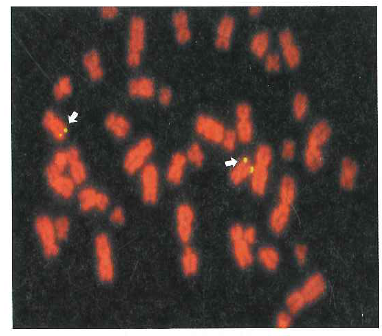 Suppose you performed a fluorescence in situ hybridization experiment (FISH) on chromosomes from a human cell using a probe corresponding to a gene located near (but not at) the telomere of the q arm of chromosome 4. a. On the following idiogram, which shows only chromosomes 1-5 contained in this diploid cell, indicate the location of all fluorescent signals. b. Compare your idiogram with the result of the FISH experiment shown in Fig. 11.9a. Why are the chromosomes scattered in Fig. 11.9a, rather than being present in neatly arranged pairs of homologous chromosomes as in the idiogram Do you think it is likely that the gene whose DNA was used as a probe in Fig. 11.9a is found on the q arm of human chromosome 4 Figure 11.9 Fluorescent In situ hybridization. (a) FISH analysis of a human cell's chromosomes. The four yellow spots show where a probe made from a angle gene hybridizes to the two sister chromatids on each of two homologous chromosomes. (b) Spectral karyotyping (SKY). Probesmade from DNA along the length of each chromosome are labeled with fluorescent tags of different colors. (a) (b)