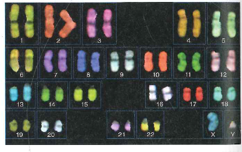 Suppose you performed a fluorescence in situ hybridization experiment (FISH) on chromosomes from a human cell using a probe corresponding to a gene located near (but not at) the telomere of the q arm of chromosome 4. a. On the following idiogram, which shows only chromosomes 1-5 contained in this diploid cell, indicate the location of all fluorescent signals. b. Compare your idiogram with the result of the FISH experiment shown in Fig. 11.9a. Why are the chromosomes scattered in Fig. 11.9a, rather than being present in neatly arranged pairs of homologous chromosomes as in the idiogram Do you think it is likely that the gene whose DNA was used as a probe in Fig. 11.9a is found on the q arm of human chromosome 4 Figure 11.9 Fluorescent In situ hybridization. (a) FISH analysis of a human cell's chromosomes. The four yellow spots show where a probe made from a angle gene hybridizes to the two sister chromatids on each of two homologous chromosomes. (b) Spectral karyotyping (SKY). Probesmade from DNA along the length of each chromosome are labeled with fluorescent tags of different colors. (a) (b)
