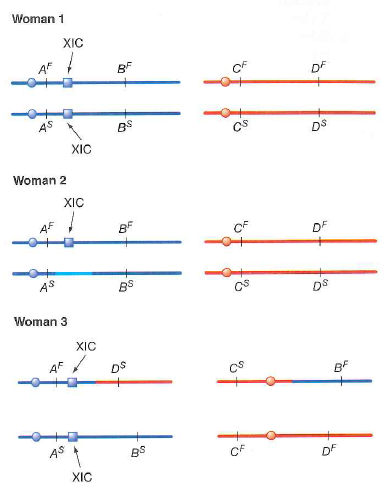 On the following figures, genes A and B are on the X chromosome ( blue ) and both are subject to X inactivation, while genes C and D are on chromosome 17 (an autosome; red ). F and S refer to alleles encoding fast-and slow-migrating forms of the corresponding proteins that can be discriminated by electrophoresis. For women 2 and 3 in the figures that follow, indicate all the possible forms of the four proteins that could be expressed in clones made from different individual somatic cells that already had one or more Barr bodies. As an example, some clones from normal woman 1 could express the A F , B F , C F , C S , D F , and D S proteins, while other clones could express the A S , B S , C F , C s , D F and D S proteins. None of the clones from woman 1 should make both the slow and fast forms of proteins A or B. Woman 2 is a heterozygote for a deletion of the XIC. Woman 3 is a heterozygote for a reciprocal translocation in which parts of the X chromosome and chromosome 17 have exchanged places.
