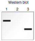 Chapter 20 describes a blotting method known as Western blotting that can be used to detect the production of a polypeptide that is translated from a particular mRNA. In this method, a protein is detected with an antibody that specifically recognizes and binds to its amino acid sequence. The antibody acts as a probe to detect the presence of the protein. In a Western blotting experiment, a mixture of cellular proteins is separated using gel electrophoresis according to their molecular masses. After the antibody has bound to the protein of interest within a blot of a gel, the protein is visualized as a dark band. For example, an antibody that recognizes the -globin polypeptide could be used to specifically detect the -globin polypeptide in a blot. As shown here, the method of Western blotting can be used to determine the amount and relative size of a particular protein that is produced in a given cell type. a. Lane 1 is a sample of proteins isolated from normal red blood cells.Lane 2 is a sample of proteins isolated from kidney cells. Kidney cells do not produce globin.Lane 3 is a sample of proteins isolated from red blood cells from a patient with -thalassemia. This patient is homozygous for a mutation that results in the shortening of the -globin polypeptide.Now here is the question. A protein called troponin contains 334 amino acids. Because each amino acid weighs 120 daltons (Da) (on average), the molecular mass of this protein is about 40,000 Da, or 40 kDa. Troponin functions in muscle cells, and it is not expressed in nerve cells. Draw the expected results of a Western blot for the following samples: Lane 1: Proteins isolated from muscle cells Lane 2: Proteins isolated from nerve cells Lane 3: Proteins isolated from the muscle cells of an individual who is homozygous for a mutation that introduces a stop codon at codon 177