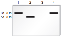 The protein known as tyrosinase is needed to make certain types of pigments. Tyrosinase is composed of a single polypeptide with 511 amino acids. Because each amino acid weighs 120 Da (on average), the molecular mass of this protein is approximately 61,300 Da, or 61.3 kDa. People who carry two defective copies of the tyrosinase gene have the condition known as albinism. They are unable to make pigment in the skin, eyes, and hair. Western blotting can be used to detect proteins that are translated from a particular mRNA. This method is described in Chapter 20 and also in experimental question E5. Skin samples were collected from a pigmented individual (lane 1) and from three unrelated albino individuals (lanes 2, 3, and 4) and subjected to a Western blot analysis using an antibody that recognizes tyrosinase. Explain the possible cause of albinism in the three albino individuals. a. Question E5 Chapter 20 describes a blotting method known as Western blotting that can be used to detect the production of a polypeptide that is translated from a particular mRNA. In this method, a protein is detected with an antibody that specifically recognizes and binds to its amino acid sequence. The antibody acts as a probe to detect the presence of the protein. In a Western blotting experiment, a mixture of cellular proteins is separated using gel electrophoresis according to their molecular masses. After the antibody has bound to the protein of interest within a blot of a gel, the protein is visualized as a dark band. For example, an antibody that recognizes the -globin polypeptide could be used to specifically detect the -globin polypeptide in a blot. As shown here, the method of Western blotting can be used to determine the amount and relative size of a particular protein that is produced in a given cell type. a. Lane 1 is a sample of proteins isolated from normal red blood cells.Lane 2 is a sample of proteins isolated from kidney cells. Kidney cells do not produce globin.Lane 3 is a sample of proteins isolated from red blood cells from a patient with -thalassemia. This patient is homozygous for a mutation that results in the shortening of the -globin polypeptide.Now here is the question. A protein called troponin contains 334 amino acids. Because each amino acid weighs 120 daltons (Da) (on average), the molecular mass of this protein is about 40,000 Da, or 40 kDa. Troponin functions in muscle cells, and it is not expressed in nerve cells. Draw the expected results of a Western blot for the following samples: Lane 1: Proteins isolated from muscle cells Lane 2: Proteins isolated from nerve cells Lane 3: Proteins isolated from the muscle cells of an individual who is homozygous for a mutation that introduces a stop codon at codon 177