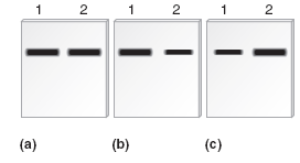 Chapter 20 describes a blotting method known as Northern blotting, in which a short segment of cloned DNA is used as a probe to detect RNA that is transcribed from a particular gene. The DNA probe, which is labeled, is complementary to the RNA that the researcher wishes to detect. After the probe DNA binds to the RNA within a blot of a gel, the RNA is visualized as a dark band. The method of Northern blotting can be used to determine the amount of a particular RNA transcribed in a given cell type. If one type of cell produces twice as much of a particular mRNA as another cell, the band appears twice as intense.For this question, a researcher has a DNA probe complementary to the ferritin mRNA. This probe can be used to specifically detect the amount of ferritin mRNA on a gel. A researcher began with two flasks of human skin cells. One flask contained a very low concentration of iron, and the other flask had a high concentration of iron. The mRNA was isolated from these cells and then subjected to Northern blotting, using a probe complementary to the ferritin mRNA. The sample loaded in lane 1 was from the cells grown in a low concentration of iron, and the sample in lane 2 was from the cells grown in a high concentration of iron. Three Northern blots are shown here, but only one of them is correct. Based on your understanding of ferritin mRNA regulation, which blot (a, b, or c) would be your expected result Explain. Which blot (a, b, or c) would be your expected result if the gel had been probed with a DNA segment complementary to the transferrin receptor mRNA