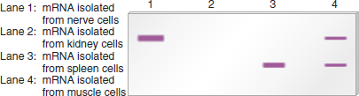 The method of Northern blotting is used to determine the amount and size of a particular RNA transcribed in a given cell type. Alternative splicing (discussed in Chapter 16) produces mRNAs from the same gene that have different lengths. A Northern blot is shown here using a DNA probe that is complementary to the mRNA encoded by a particular gene. The mRNA in lanes 1 through 4 was isolated from different cell types, and equal amounts of total cellular mRNA were added to each lane. a. Explain these results.
