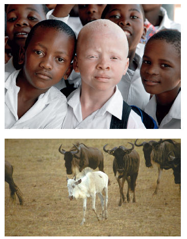Figure 24.1 illustrates albinism in two different species. Describe two other genetic disorders found in both humans and animals.FIGURE 24.1 The albino phenotype in a human and a wildebeest.