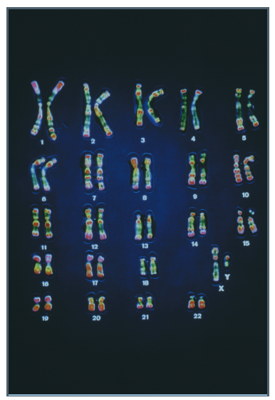 Figure 1.5 shows a micrograph of chromosomes from a normal human cell. If you performed this type of experiment using cells from a person with Down syndrome, what would you expect to see FIGURE 1.5 A micrograph of the 46 chromosomes found in a cell from a human male.