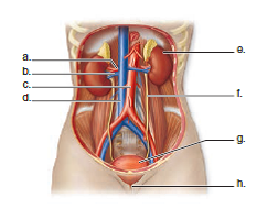 Choose the best answer for each question. Label the following diagram of the urinary system and nearby blood vessels.