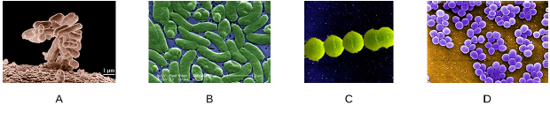 Which of the following slides is a good example of staphylococci?