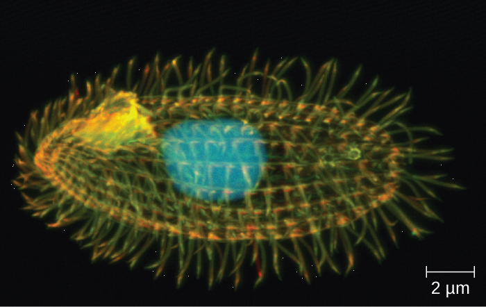 The protist shown in the picture has which of the following? a. pseudopodia b. flagella c. a shell d. cilia