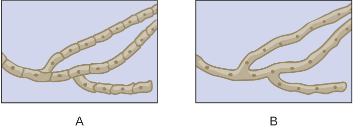 Which of the drawings shows septate hyphae?