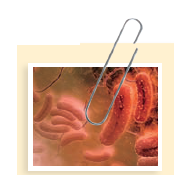 coli O104:H4: The Ugly Stepsister of E.coli O157:H7 In May 2011, disturbing reports of outbreaks of enterohemorrhagic E. coli (EHEC) began to emerge from Germany. Generally, strains of E. coli cause relatively mild cases of diarrhea, also known as traveler's diarrhea, or a mild form of dysentery, both of which resolve with minimal treatment. When the reporting of illness subsided in mid-June, there were a total of 855 cases of hemolytic uremic syndrome (HUS) and 2,987 cases of acute gastroenteritis associated with the outbreak. Thirty-five deaths were attributed to HUS, while 18 were due to EHEC gastroenteritis, making this the largest outbreak of food-borne disease ever recorded in Germany. Cases were reported throughout all of the states of Germany, and a majority of the cases were tied to consumption of contaminated bean sprouts. Epidemiologists linked several cases from the German outbreak to other cases found in Bordeaux, France. Six cases of illness and one death in the United States were linked to the outbreak, and all patients were determined to be recent travelers to Germany. What are the steps that should be taken to identify the specific cause of this outbreak How is a case of EHEC different than other food-borne infections caused by E. coli Cases of EHEC are usually associated with the notorious strain E. coli O157:H7, but this outbreak was caused by the lesser-known strain E. coli O104:H4. Both strains of E. coli produce the Shiga toxin that causes bloody diarrhea and HUS, but the O104:H4 strain had previously not been found in animals and only rarely in humans. Scientists and doctors analyzed stool samples of patients showing symptoms of EHEC and HUS in an attempt to isolate the Shiga-toxin-producing pathogen. Genomic analysis of specimens revealed that the O104:H4 strain rather than the O157:H7 strain was causing illness in the patients. Moreover, the scientists confirmed that it was resistant to at least 14 different antibiotics. What type of microbial media might have been used to identify E. coli O104:H4