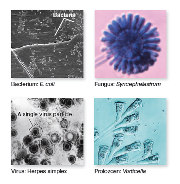 From chapter 1, figure 1.6. Which of these photos from chapter 1 is an SEM image Which is a TEM image Figure 1.6 Five types of microorganisms. The drawing at top right shows relative size differences. The photos of organisms around the drawing are pictured at different magnifications in order to show their details.