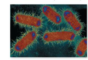 From chapter 4, figure 4.11 a. Speculate on why these cells contain two chromosomes (shown in blue). figure 4.11 a Form and function of bacterial fimbriae. (a) Several cells of pathogenic Escherichia coli covered with numerous stiff fibers called fimbriae (30,000×). Note also the dark-blue granules, which are the chromosomes.