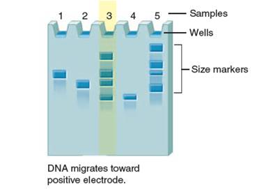 Critical thinking is the ability to reason and solve problems using facts and concepts. These questions can be approached from a number of angles and, in most cases, they do not have a single correct answer. Based on the following image: a. Explain where the charges should be applied to this gel in order for the DNA samples to migrate properly. b. Identify the largest DNA fragment in sample 5. Explain your selection.