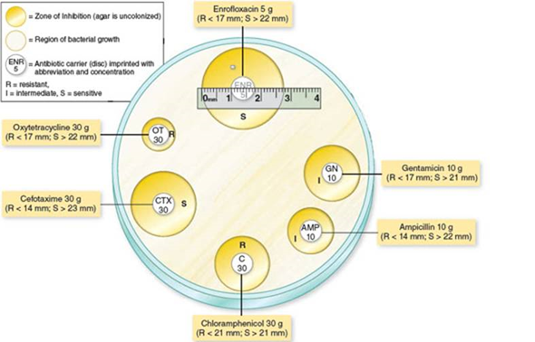 Referring to figure 12.1 a , determine whether the cultured bacterium is sensitive, intermediate, or resistant to each of the antibiotic drugs tested and provide an explanation in each case. b. Referring to figure 12.3 a , determine the minimum inhibitory concentration (MIC) of the drugs being tested, providing an explanation for your answer. Figure 12.1a Technique for preparation and interpretation of disc diffusion tests. (a) Standardized methods are used to seed a lawn of bacteria over the medium. A dispenser delivers several drug-impregnated discs onto a plate, followed by incubation. Interpretation of results: During incubation, antimicrobials become increasingly diluted as they diffuse out of the discs into the medium. If the test bacterium is sensitive to a drug, a zone of inhibition develops around its disc. Roughly speaking, the larger the size of this zone, the greater is the bacterium's sensitivity to the drug. The diameter of each zone is measured in millimeters and evaluated for susceptibility or resistance by means of a comparative standard (see table 12.3). (a) *R and S values differ from table 12.3 due to differing concentrations of the antimicrobials. Table 12.3 Results of a Sample Kirby-Bauer Test Figure 12.3a: Tube dilution test for determining the minimum inhibitory concentration (MIC). (a) The antibiotic is diluted serially through tubes of liquid nutrient from right to left. All tubes are inoculated with an identical amount of a test bacterium and then incubated. The first tube on the left is a control that lacks the drug and shows maximum growth. The first tube in the series that shows no growth (no turbidity) contains the concentration of antibiotic that is the MIC.