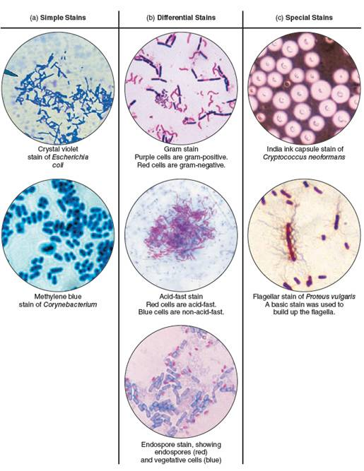 From chapter 3, figure 3.21. Without looking back to the figure in chapter 3, speculate on which meningitis-causing organism you are seeing here. How could your presumptive diagnosis be confirmed Figure 3.21 Types of microbiological stains. (a) Simple stains. (b) Differential stains: Gram, acid-fast, and spore. (c) Special stains: capsule and flagellar.