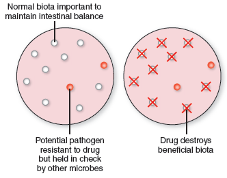 From chapter 12, figure 12.15. Assume that the growth on the first plate represents normal intestinal microbiota. How could you use these illustrations to explain the development of C. difficile -associated colitis Figure 12.15: The role of antimicrobials in disrupting microbial biota and causing superinfections. (a) A primary infection in the throat is treated with an oral antibiotic. (b) The drug is carried to the intestine and is absorbed into the circulation. (c) The primary infection is cured, but drug-resistant pathogens have survived and create an intestinal superinfection.