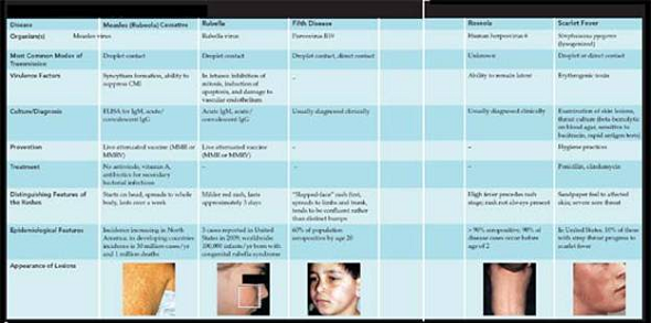 From chapters 20 and 23, figures 20.16 and 23.13 a. Compare these two rashes. What kind of information wouldhelp you determine the diagnosis in both cases b. Now compare both of these to the rashes summarized in Disease Table 18.7 (p. 532-533). Which of the diseases in Disease Table 18.7 most resembles the rashes in the preceding question, and how would you distinguish among it, the rash from figure 20.16, and the one from figure 23.13 a Figure 20.16: The rash in RMSF. This case occurred in a child several days after the onset of fever. Also pictured is an example of the hard ticks that transmit the infection. Figure 23.13 a : Symptom of secondary syphilis. The skin rash in secondary syphilis can form on the trunk, arms, and even palms and soles (these latter locations are particularly diagnostic). The rash does not hurt or itch and can persist for months. Disease Table 18.7: Maculopapular Rash Diseases