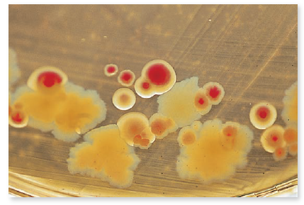 From chapter 3, figure 3.5 b. If this MacConkey agar plate was inoculated with well water, would you report that coliforms were present in the water Figure 3.5 b: Examples of media that are both selective and differential. (b) MacConkey agar selects against gram-positive bacteria. It also differentiates between lactose-fermenting bacteria (indicated by a pink-red reaction in the center of the colony) and lactose-negative bacteria (indicated by an off-white colony with no dye reaction).