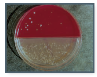 From chapter 3, selective and differential media. This is a plate with blood agar on the top and MacConkey agar on the bottom. (You studied both of these agars in chapter 3.) It has been inoculated with samples from a wooden cutting board that had been exposed to a raw chicken carcass. Knowing what you know about the properties of these two agars, say as much as you can about the bacteria growing on them.