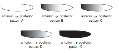 Bicoid mRNA is maternally derived and localized to the anterior of early Drosophila embryos. Bicoid protein is a concentration-dependent transcriptional activator of the hunchback gene. Depicted below are embryos in which a reporter is expressed under the control of the wild-type hunchback promoter. The darkened regions indicate reporter expression. Use these patterns to answer the following questions. A. Which expression pattern would you expect in embryos from a mother that does not express bicoid mRNA? Explain. B. Drosophila flies are diploid organisms. This results in a pattern of reporter expression that most closely resembles pattern C. Would you expect this pattern to change if the mother had only one copy of the bicoid gene? If no, explain why not. If yes, explain and select the most likely expression pattern from the choices above. C. The hunchback promoter contains high-affinity and low-affinity binding sites for Bicoid protein. Which expression pattern would you expect if the hunchback promoter was mutated so that it now contains only the low-affinity binding sites for Bicoid protein and the mother has two copies of the bicoid gene? Explain your choice.