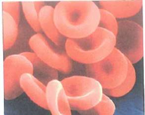 Fig. is a picture of red blood cells seen under a scanning electron microscope. Normally, women possess about 4.5 million of these cells in each cubic millimeter of blood. If the blood flow to the heart is 250 mL/min, how many red blood cells does a woman's heart receive each second FIGURE Red blood cells See Exercise.