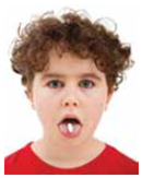 One controversy over ADHD is that, as of this writing, the diagnosis of ADHD is based on (a) _____ observations, which are not always clear-cut, rather than on more reliable (b) _____ tests. Another controversy involves how best to treat ADHD. For more severe ADHD, researchers recommend a combination of (c) _____ and (d) _____ treatment. However, even though Ritalin can decrease hyperactivity in children and increase their ability to pay (e) _____ , Ritalin does not necessarily improve reading or social skills and does not necessarily reduce problems occurring during adolescence and adulthood.
