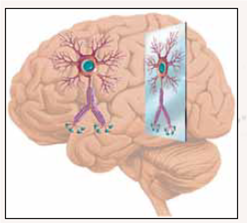 Mirrors in Your Brain? When we see someone yawn, we yawn too. When we watch a spider crawl up someone's leg, we get creepy sensations on our leg. When we see someone in danger, we experience a wave of fear. When we see someone's arm get jabbed with a sharp needle, the muscles in our arms tense up and our breathing intensifies. When we watch our favorite Olympic athlete near the finish line to win first place, our heart races with excitement. How can simply observing others lead us to experience such intense responses so similar to those experienced by the people we are observing? The answer is found in our brain cells. A type of neuron, called a mirror neuron, helps explain how we effortlessly read other people's minds and empathize with them?feel what they do. Mirror neurons automatically put us in somebody else's shoes. Not convinced? Consider brain scan research that finds that romantic partners who observe loved ones in pain show similar activity in their emotional brain areas as that experienced by the loved ones. It turns out that when we empathize with someone's pain, on some level we actually feel pain! One fascinating characteristic of mirror neurons is that they are the only brain cells that are activated the same way whether we are seeing or doing. These special neurons mirror what the other person is doing. For instance, when we see someone smiling, our mirror neurons for smiling get activated, which triggers neural activity leading to feelings associated with smiling, such as happiness. In other words, we get all the benefits of smiling without making even the slightest movement of our lips! Mirror neurons also help us understand someone's intentions. They get activated when we watch someone do something, which helps us predict what their goal is and what they may do next. For example, if you see a boy begin to reach for candy on the counter in front of him, you have a copy of what he is doing in your brain, which helps you to understand his goal (getting the candy). Research on mirror neurons is still in its infancy, and much has yet to be learned. But, for now, those of us who are embarrassed by our free-flowing tears during dramatic scenes in television programs, movies, and, yes, sometimes even commercials should be relieved to know that the emotions we experience may be out of our control; that is, we may not be able to contain our tears after all. Question Which modern approaches to psychology are best suited to study mirror neurons?