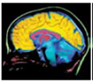 There are several techniques for studying the living brain. One method for identifying structures in the brain involves measuring nonharmful radio frequencies as they pass through the brain; this is called an (a) _____ scan. Another method that is used to study functions of the brain involves measuring the amounts of low-level radioactive substances absorbed by brain cells; this is called a (b) _____ scan. A method that involves placing electrodes on the scalp and measuring changes in brain wave activity is called an (c) _____.