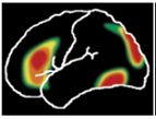 There are several recently developed techniques for studying the living brain. One technique, which measures nonharmful radio frequencies as they pass through the brain, is called an (a) _____ and is used to identify structures in the living brain. Another technique measures how much of a radioactive substance is taken up by brain cells and is called a (b) _____. this kind of scan is used to study brain function and identify the most and least active parts. Another technique measures brain wave activity by placing electrodes on the scalp and is called a (c) _____.