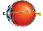 The retina has several layers of cells, but only the very back layer contains photoreceptors. The photoreceptors that are used to see in dim light and transmit only black, white, and shades of gray are called (a) _____ Photoreceptors that are used to see in bright light and transmit colors are called (b) _____