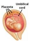 The development of the fetus can be interrupted or damaged by a variety of toxic agents, called (a) _____ which cause malformation of the brain or body and result in birth defects. For example, heavy drinking during pregnancy can cause a combination of physical and psychological deficits called (b) _____ which is the leading known cause of intellectual disability in the United States.