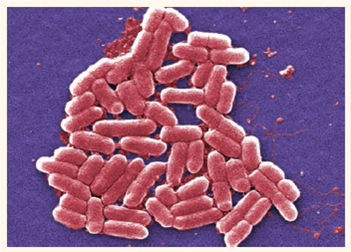 The electron micrograph to the right shows a group of bacterial cells. The micrograph has been magnified 5,000X. Calculate the actual length of the bacterial cells in micrometers ( m) Courtesy of Janice Hanley Carr/CDC.