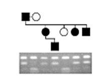 <strong>Pedigree analysis was used to determine whether a genetic marker is inherited with a disease trait (black symbols). Results of Southern blot analysis of restriction endonuclease-digested DNA from members of the family are shown. What conclusions can be drawn from the data? </strong> A) A restriction fragment length polymorphism (RFLP) is linked to this autosomal recessivetrait. B) A restriction fragment length polymorphism (RFLP) is linked to this autosomal dominanttrait. C) The disease is caused by expansion of a trinucleotide repeat. D) No information can be gained from this analysis because researchers should haveperformed a Northern blot, not a Southern blot.