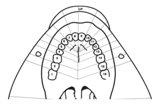 Color in the field of anesthesia and list the structures anesthetized by an AMSA nerve block.  <div style=padding-top: 35px> 