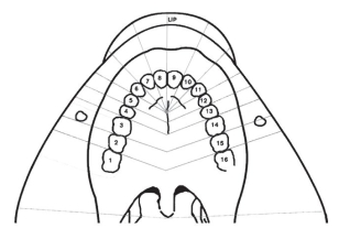 Color in the field of anesthesia and list the structures anesthetized by a PSA nerve block.