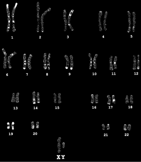 <strong>In what way(s)would the karyotype shown below be different if the material used to prepare the analysis were an egg or sperm cell? </strong> A)The total number of chromosomes would be 23 in this example. B)No homologous pairing would be possible. C)The sex chromosome would be represented by a single X or a single Y rather than a pair. D)all of the above