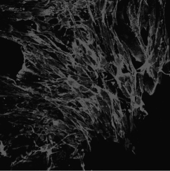 <strong>The illustration below shows bone marrow stem cells; it is most likely that these stem cells are _____ because they are derived from _____. </strong> A)totipotent; mesenchymal embryonic tissue B)pluripotent; tissues that do not contribute to the production of the placenta or embryonic membranes C)multipotent; a mature organ system that already shows differentiation D)totipotent; the inner cell mass of the bone marrow