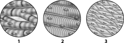 <strong>Analyze the tissue images below and select which statement is true. </strong> A)Tissue 1 can be found lining the digestive tract. B)Tissue 1 is used to line the endocrine system. C)Tissue 2 is found attached to bones. D)Tissue 3 is used to conduct nerve impulses