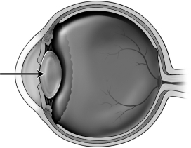 <strong>The figure below depicts a human eye. When focusing on an object that is far away, the structure indicated by the arrow in the figure above</strong> A)becomes flatter. B)becomes more spherical. C)does not change. D)decreases in diameter.