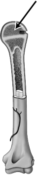 <strong>The illustration below </strong> A)reveals that bone contains both hard and soft components. B)suggests that bones are extremely rigid. C)shows that bones are heavy and densely packed. D)highlights how bones are very fragile.